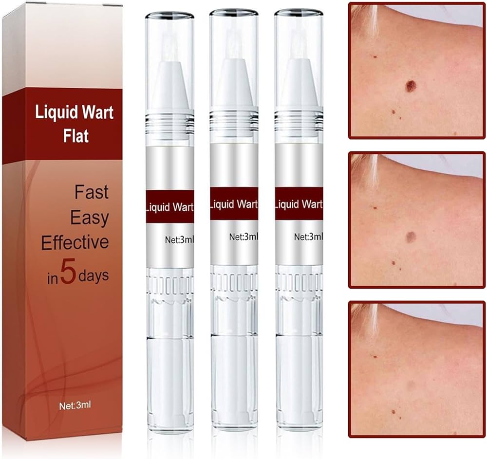 Skin Tag Remover Pen Liquid Wart Remover