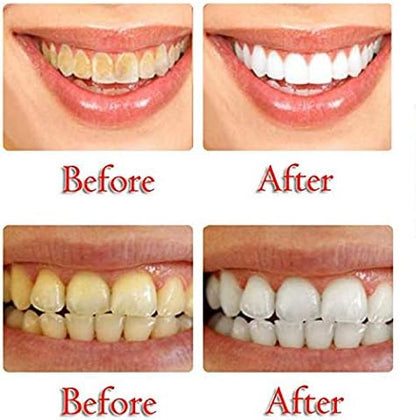 Baking Soda Toothpaste Teeth Stain Removal Rahma Beauty Store