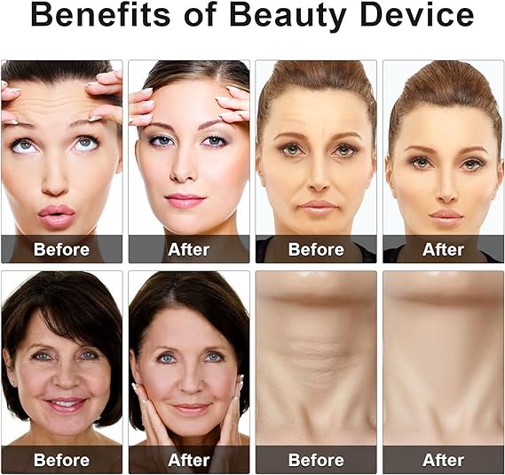 Eye Beauty Device Rahma Beauty Store